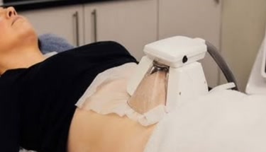 Bauchfettabsaugung 2026: Preise, Laseroptionen und nicht-operative Fettentfernung