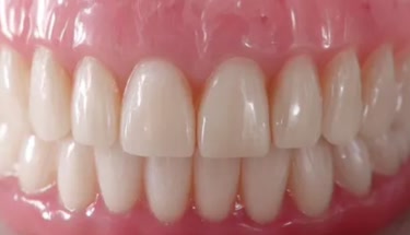 Essential Guide to Covered Dentures for Seniors: Choosing the Right Option for Comfort and Care