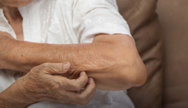 3 Causes Of Sudden Itching In The Elderly