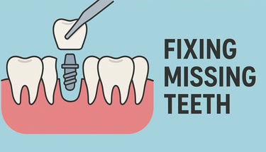 How to fix missing teeth: Exploring your options