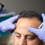 A Comprehensive Guide to Finding the Best Hair Transplant Solution, Surgeon, and Clinic Near You