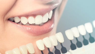 Achieve Your Ideal Smile with Cosmetic Dentistry Grants
